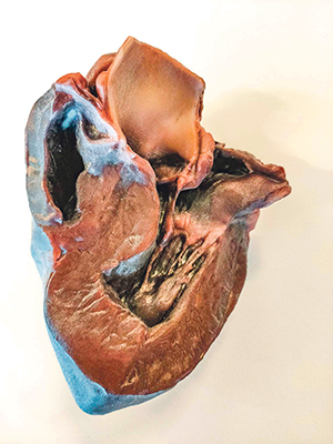 Mimaki 3D printing brings colour to the ‘beauty’ of anatomy